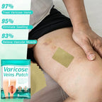 2 Pack LegRenew Varicose Veins Patch, Professional Varicose Veins Treatment for Legs, Natural Ingredients Leg Treatment, Varicose Veins Patch for All Skin Types