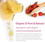 Organic Rosehip Seed Oil for Face, USDA Certified, Cold Pressed, Unrefined, 100% Pure Natural Rose Hip Oil for Anti-Aging, Acne Scar Treatment, Skin & Hair Care, Gua Sha Massage, 1 fl.oz / 30ml