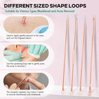 FEITA Blackhead Remover Pimple Comedone Extractor Tool, Stainless Acne Tools Pimple Popper Removal Kit, Zit Whitehead Popping Needle for Nose & Face, Rose Gold 4Pcs