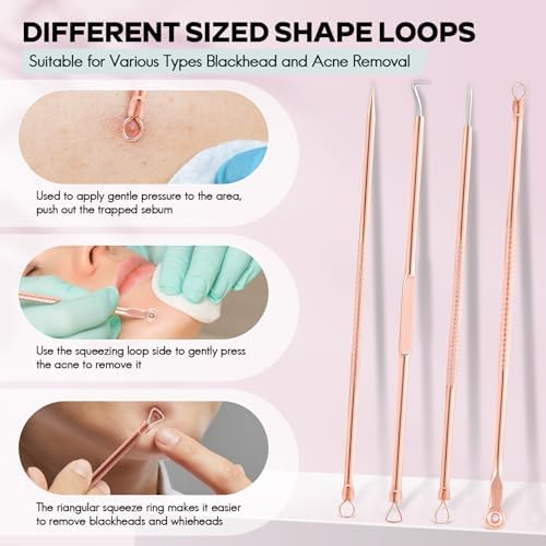 FEITA Blackhead Remover Pimple Comedone Extractor Tool, Stainless Acne Tools Pimple Popper Removal Kit, Zit Whitehead Popping Needle for Nose & Face, Rose Gold 4Pcs