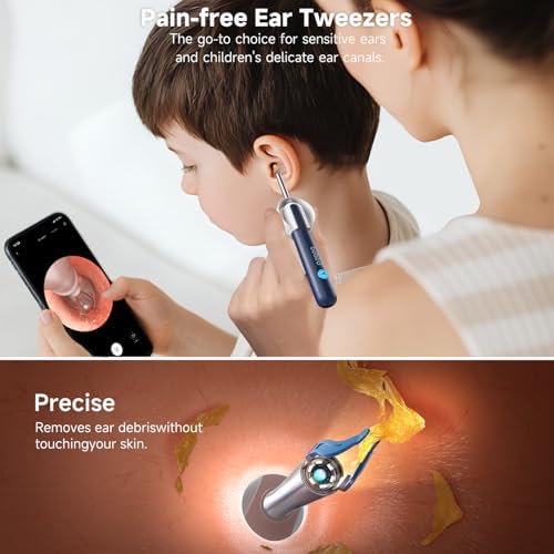 BEBIRD Ear Wax Removal, Ear Cleaner with Camera Wireless Otoscope with 1080P HD Waterproof Digital Endoscope with 6 LED Light, Mom Gadgets for Baby Ear Cleaners Checking