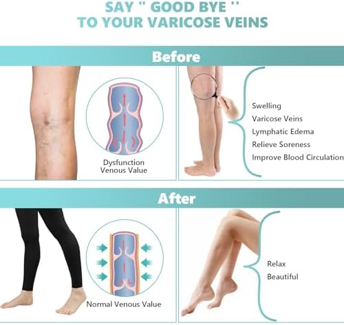 Compression Pantyhose for Women, 20-30 mmHg Footless Medical Compression Stockings, Waist High Opaque Graduated Support Compression Hose Tights for Edema, Varicose Veins, Swelling