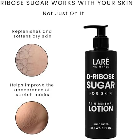 Ribose Sugar for Skin - Ribose Cream - D-Ribose - Working Hands Cream - Lightweight Moisturizer with D-Ribose & Vitamin E - 8 fl oz - Unscented