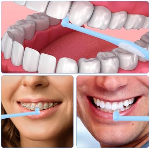 Ouligay 4Pcs End Tuft Toothbrush Adult Tufted Brush Single Tuft Toothbrushes Small Head Tiny Interdental Interspace Toothbrushes Orthodontic Toothbrush for Braces Detail Cleaning