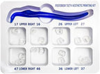 Dental Posterior Teeth Aesthetic Printing Kit, Temporary Tooth Repair Kit for Missing Broken Teeth Rubber Dental Filling Restoration Tool.