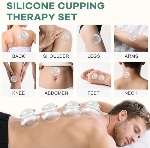 ELERA Silicone Cupping Therapy Set – Silicone Cups for Cupping in 4 Sizes (XL, L, M, S) for Cellulite Massage, Deep Tissue Relaxation & Full-Body Wellness (4-Pack)