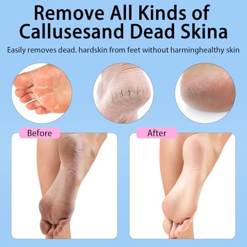 Electric Foot Callus Removers Rechargeable - Electric Foot File with 9 Adjustable Speed, 2 Grinding Heads & 30 Pcs Sandpaper Discs,Professional Foot Sander for Feet Dead Skin and Calluse (Pink)