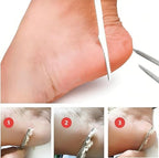 Stainless Steel Foot Files Callus Removers 2Pcs Pedicure Kit Skin Scraper for Men and Women Durable Foot Care Tools for Hard Skin Removal
