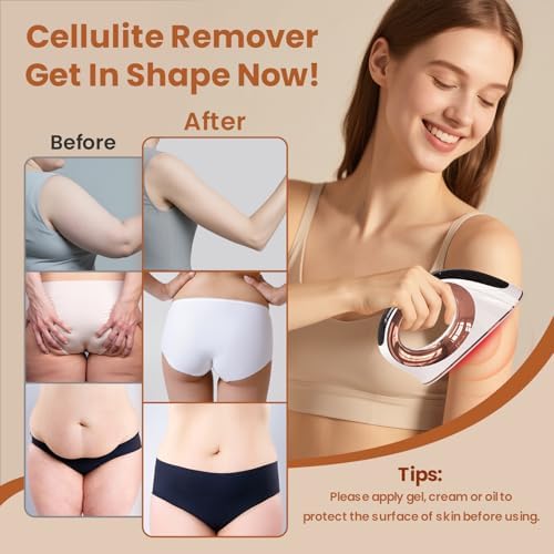 Cellulite Massager, Body Sculpting Machine Radio Frequency Device for Body Massage and Cellulite Removal, Suitable Use on Belly, Arm, Waist, Leg