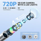 ScopeAround Otoscope, 720PHD Ear Scope Set, Digital Otoscope w/1.85in IPS Screen, Ear Wax Removal Tool Camera, Video Otoscope Ear Camera with 6 LED Lights, Compatible with Android/iPhone