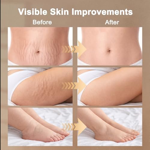 Lymphatic Drainage Massager, Lymphatic Massager, Helps Reduce Stretch Marks & Cellulite, for Legs, Arms & Belly, Body Sculpting Machine with Microcurrent, Light, Heat & Vibration, White