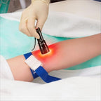 Vein Finder is Used to Display View and Locate The Blood Vessels, Handy Efficiency Vein Locator On Various Skin, Handheld Vein Illumination Detector