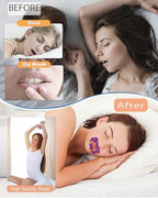 Non Woven, Hypoallergic,Regular Size for All Ages Users, Easy for First Time User
