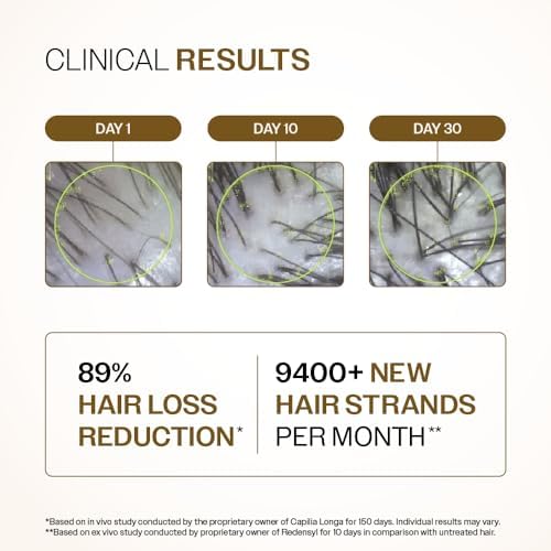 Bare Anatomy Advanced Hair Growth Serum| 3% Redensyl - 2x Better Results than Minoxidil | + 4% Anagain + 3% Baicapil | Rosemary, Biotin | Hair growth & Hair fall control serum for Women & Men | 30mL