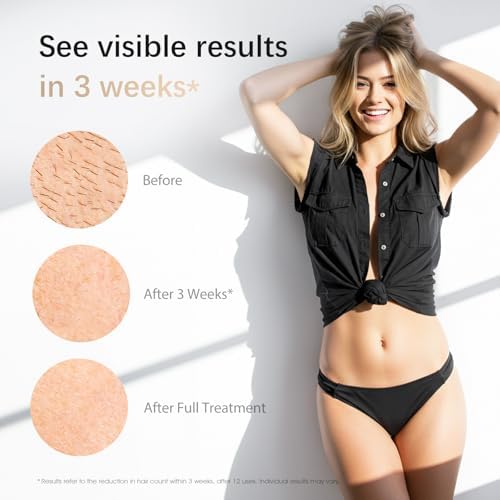 IPL Laser Hair Removal Device for Women & Men - Safe At-Home 45°F Ice-Cooling Contact for Painless & Long-Lasting Results, 86% Less Hair In 3 Weeks for Full Body & Face, Green
