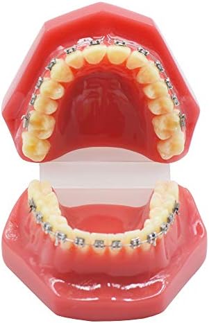 Dental Orthodontic Metal Brcket with Typodont Teeth Model
