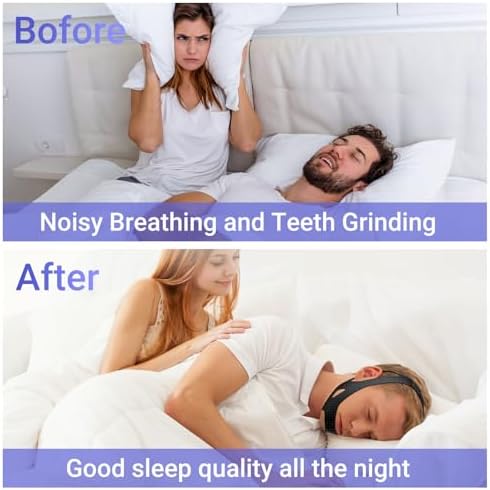 CPAP Chin Strap for Sleep, Anti Snoring Jaw Strap for Men & Women, Breathable Stop Snoring Solution to Keep Mouth Closed, Adjustable Snore Stopper & Sleep Support Device（Black）