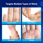 Fast-Acting Wart Remover Freeze Off & Corn Remover, 2-Pack 30 ml Salicylic Acid Plantar Wart Remover for Feet, Hands & Skin - Professional Wart Removal, NDC Code: 76986-024