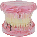 Teeth Model Teeth Typodonts Dental Implant Study Analysis Demonstration Teeth Model #2001 with Restoration Pink