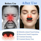 Red Light Nose Care Device, LED Nose Wellness Tool for Daily Nasal Comfort, USB Rechargeable Portable Design with 3 Light Modes & Auto Shut-Off, Lightweight, Black, 1PC