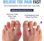 Dr. Frederick's Original Hammer Toe Corrector Gels - 2 Pairs - All-Day Relief for Crooked & Overlapping Toes - Soft Cushioning - Symptomatic Support for Toe Alignment - White - 1 Loop Design
