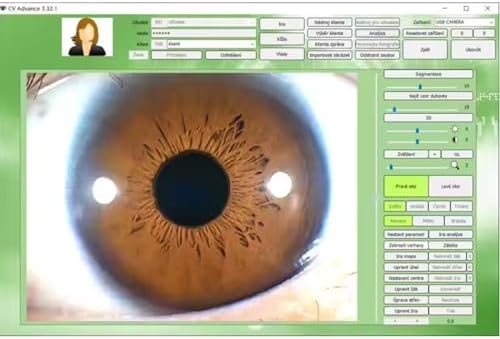 5.0 MP USB Iridology Camera Analyzer, Iris Analysis Camera, High Resolution Ccd USB Iriscope Eye Iridology Camera, HD 30x Iris Lens Analysis English Pro Iris Software