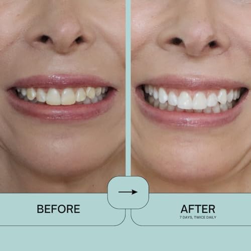 IntelliWHiTE ProStrips Teeth Whitening Strips, Whitens Up to 12 Shades, Enamel-Safe Gentle Remineralizing Formula, Dentist Formulated for Sensitive Teeth, (28pk Mint Flavor)