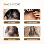 Bare Anatomy Advanced Hair Density Roll-On| 3% Redensyl + 4% Anagain + 2% Baicapil + 5% Rosemary, Rice Water, Biotin & Saw Palmetto| Reduces Hair Fall, Supports Hair Growth for Men & Women | 25ml
