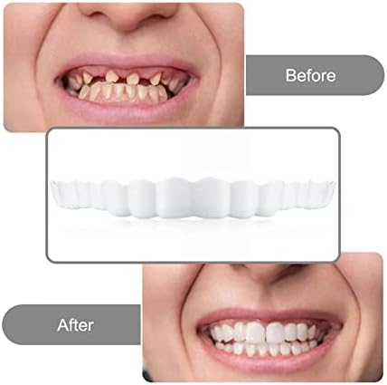 3 Pairs Instant Veneers Dentures Fake Teeth Braces Smile Teeth Top Fake Teeth Whitening Cosmetic Tooth Covering for Men and Women for a Confident Smile