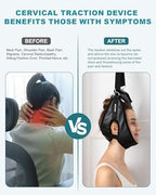 Neck Stretcher Cervical Traction Device for Home Use - Over The Door Cervical Traction Device for Decompression Home Physical Therapy, Portable Neck Traction Device for Neck Pain (with Box)