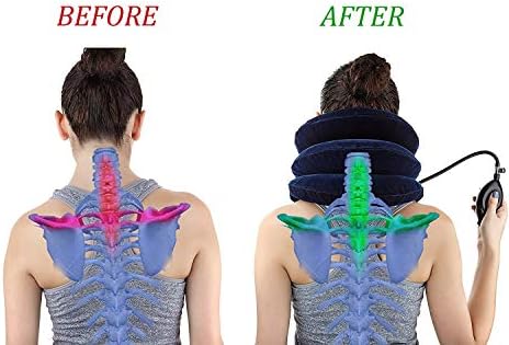 Cervical Neck Traction Device Inflatable Neck Stretcher, Easy to Use for Chronic Neck and Shoulder Pain Relief Traction Spine Alignment, Neck Cervical Brace