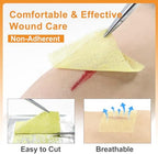 Carbou Medical Xeroform Petrolatum Dressing 2"x2", 25 Individual Pack, Non-Adherent Gauze Pads, Soft Fine Mesh Gauze Patch for Wound Care, Burns, Lacerations, Skin Grafts & Surgical Incisions