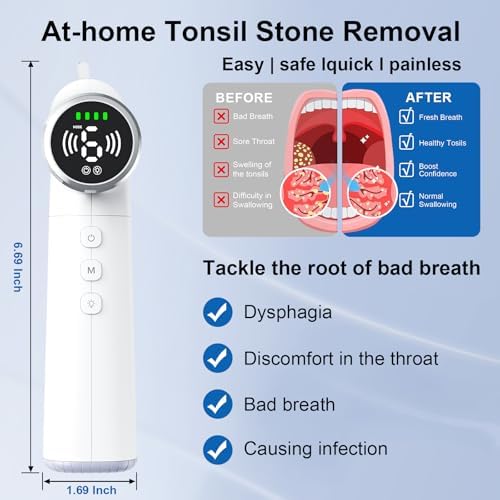 Upgraded Tonsil Stone Remover Tool – Rechargeable Tonsil Stone Vacuum with LED Light & 11-in-1 Probes, for Bad Breath Relief, Safe Silicone/Glass Tip for Tonsilloliths Removal (OFF-White)