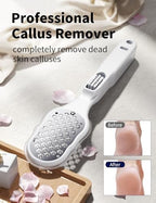 Foot Scraper, Foot Rasp, Foot Files Callus Remover, Foot Scrubber Dead Skin Remover Tool, Heel File to Remove Hard Skin and Corns, for Dry and Wet Feet