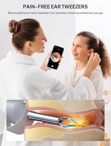 Ear Wax Removal Tool Camera, Visible Ear Cleaner Earwax Remover Kit with Tweezers, Flexible Ear Scope Otoscope with Light, Portable Cleaning Kit Earpick for Adults & Kids