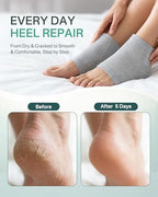 4 Socks Moisturizing Socks for Women, Silicone Socks & Gel Socks, Heel Socks for Dry Cracked Feet, Heel Protectors for Cracked Heel Treatment, Foot Care Socks, Toeless Socks for Women and Men, Gray