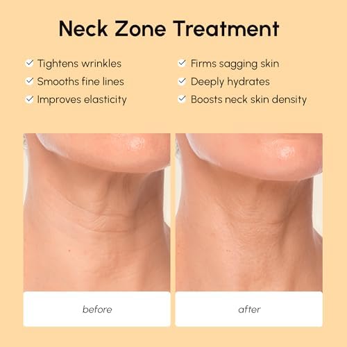 MAREE Neck Wrinkle Patches – Collagen Anti-Wrinkle Patches with Retinol & Hyaluronic Acid for Face Lift – Neck Mask for Tightening and Firming – Neck Lifting Mask & Face Tape for Neck Wrinkles – 5 Pcs
