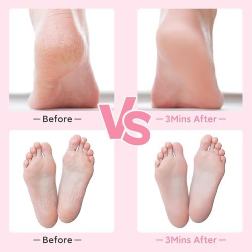 Glass Foot File Callus Remover，Portable Foot Scrubber for Dry, Cracked & Rough Skin, Pedicure Tool for Wet & Dry Feet