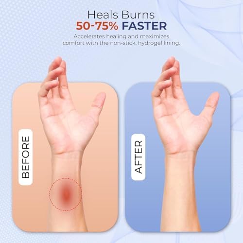 BurnFIX® Burn Kit First Aid Recommended by Doctors, Comprehensive 25pcs First Aid Kit Includes Burn Gel, Burn Dressing, Gloves, Scissors, Wipes for Quick Burn Relief - Sunburn, Electrical, Flame Burns