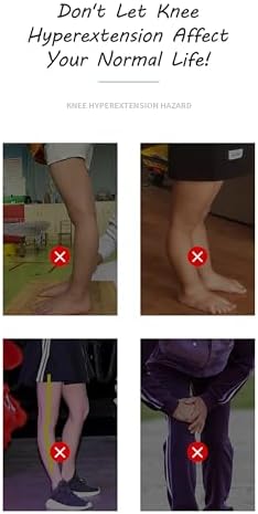 Medial Unloader Knee Brace Anti Hyperextension Knee Brace Knee Immobilizer Support for Arthritis Pain, Osteoarthritis, Bone on Bone Knee Joint Pain