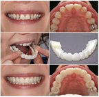 2 Pairs,Regain Confidence Smile,Adjustable for Men and Women,Temporarily Adjustable (1)