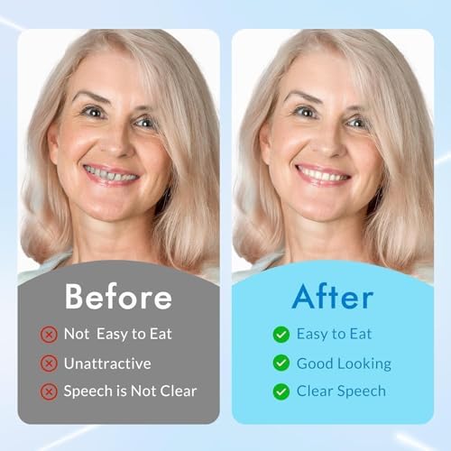 Moldable False Teeth - Silicone Dentures - Men and Veneers Teeth for Women - Upper and Lower Matching Set, Convenient and Quick, Suitable for Daily, Party - 1PCS - MU6