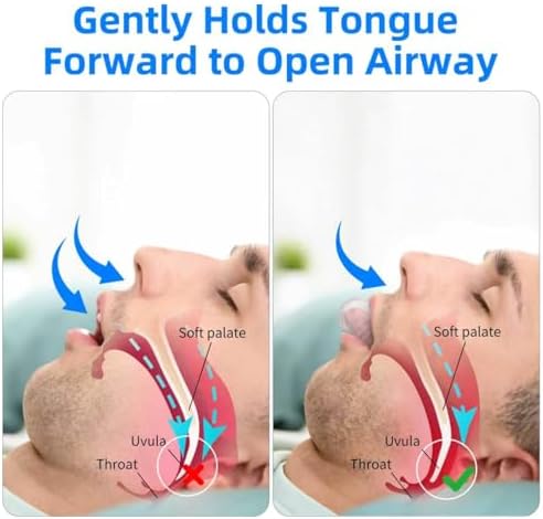 Anti-Snoring Device – Reusable Snoring Solution Mouthpiece for Men & Women, Tongue Holder for Sleep Apnea, Effective Snore Stopper for Quiet Night