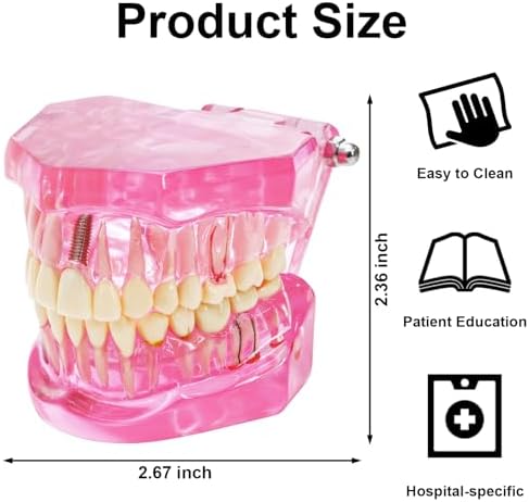 ZENFUN Disease Teeth Model with Dental Implant Bridge, Dental Model for Patient and Dental Student Education, Teeth Typodonts Analysis Demonstration Teeth Model Standard Size (Pink)