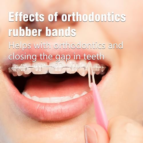 Orthodontic Elastic rubber bands 500 pcs (Medium, 3.5 Oz,1/4,Fox),Teckolign Orthodontic Elastic Rubber Bands, 500 Pack,Great for Dreadlocks, Braids, Tooth Gap, Braids, Dog Bows, Top knots, 5 Pack,with Elastic Placer for Braces. Good Orthodontic Supplies