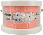 Standard Orthodontic Teeth Model, YOUYA DENTAL Demonstration Orthodontic Model Teeth Teach Study Tools with 1/2Metal and 1/2Ceramic Bracket (1/2Metal and 1/2Ceramic)