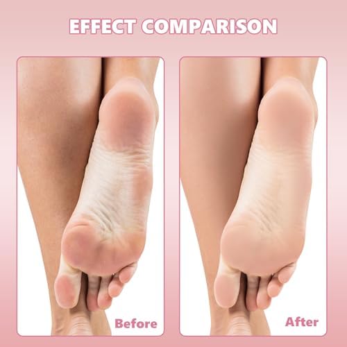 Flutesan 120 Pcs Stainless Steel Foot File Replacement Pads 180 Grit Pedicure Refill Pads Coarse Fine Pedicure File Refills Foot Rasp with Removable Glue for Callus Dead Skin, Black