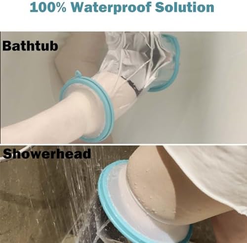 CIVJET Cast Covers for Shower Leg, Waterproof Cast Cover for Showering, Knee Surgery Recovery Equipment, Waterproof Knee Brace, Knee (Diameter - 7.9")