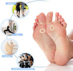 150 Pcs Corn Pads For Feet, Corn Cushions Self Adhesive Metatarsal Foot Pads, Soft Foot Care Cushions Bunion Pad Protectors Pressure And Friction From Shoes