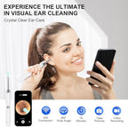 High-Definition Ear Wax Removal, Wireless Ear Cleaner, Safe and Gentle Ear Wax Removal Kit, Rechargeable Ear Cleaner with Camera and Light, Ear Cleaning Kit for Android and iOS (White)